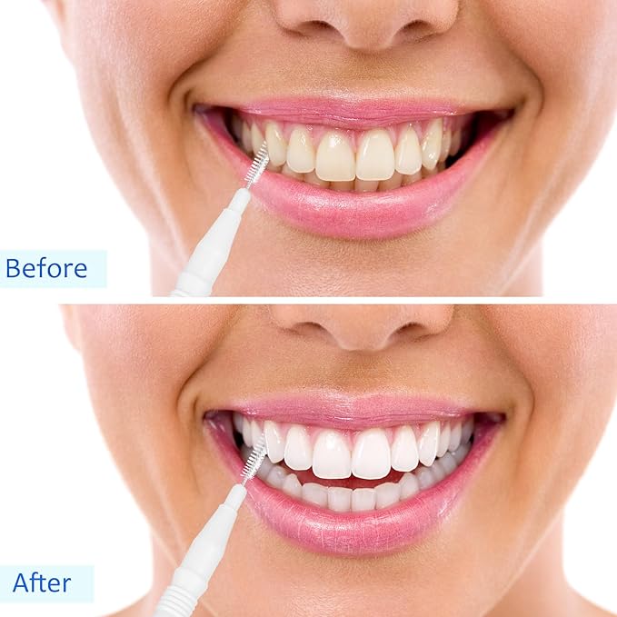 BBTO 100 Pcs Braces Dental Brush Flosser for Cleaner Interdental Brush Toothpick Tooth Flossing Head Oral Dental Toothpick Cleaners Cleaning Tool(White)