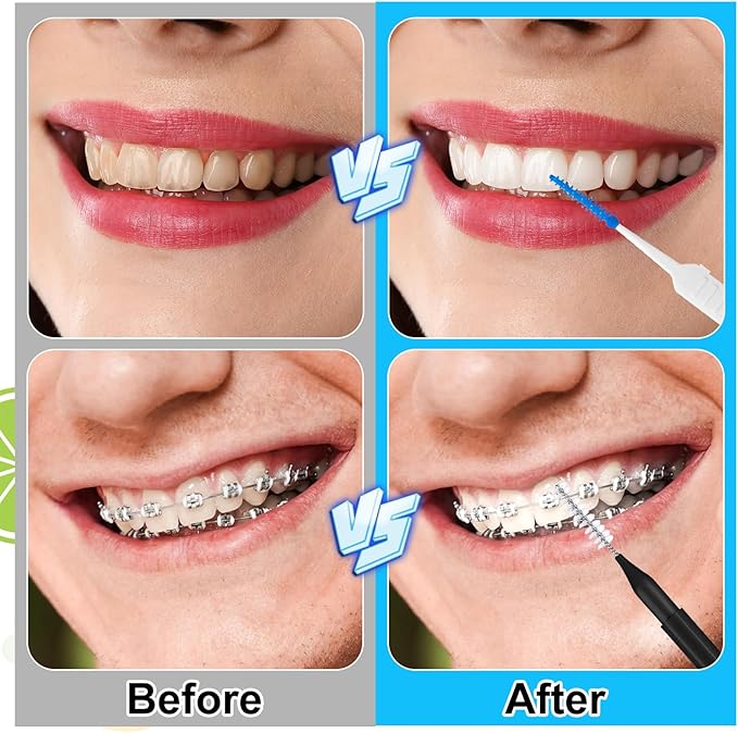 255 Pieces Braces Flossers for Braces, Interdental Brush Soft Dental Floss Picks Braces Cleaning Kit Toothpick Dental Brush Braces Teeth Flossers Brushes for Tooth Cleaner(Black)