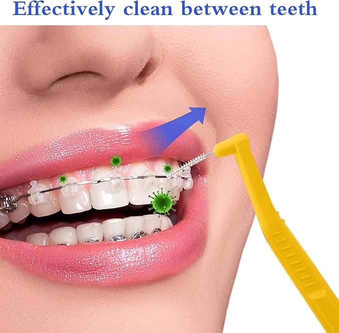 Angzhili 25 Pcs Interdental Angle Brushes,Reusable Dental Cleaners,Oral Dental Hygiene Brush,Dental Toothpick Floss for Braces,Tooth Cleaning Tool (Yellow)