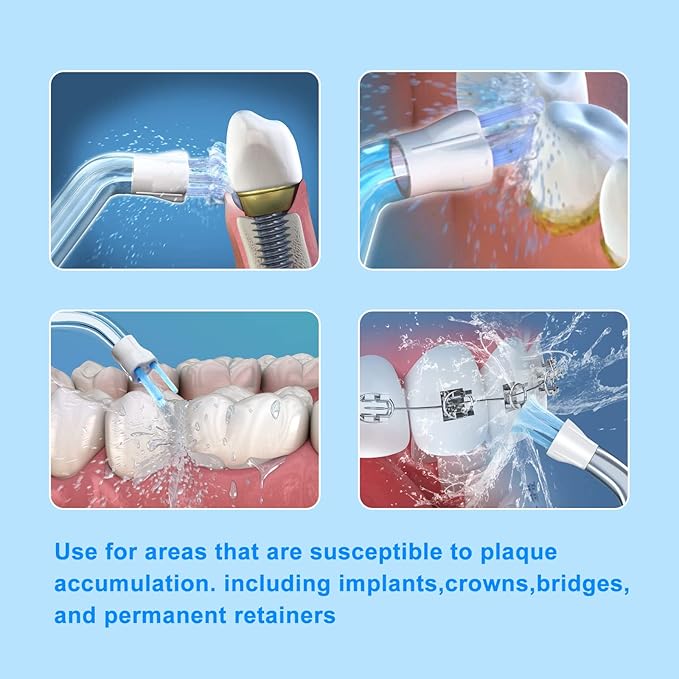 Flosser Replacement Tips for Waterpik Water Flosser, Replacement Tips Compatible with Waterpik Water Flossers and Other Brand Oral Irrigators, Plaque Remove Brisles Tips(6-Pack)