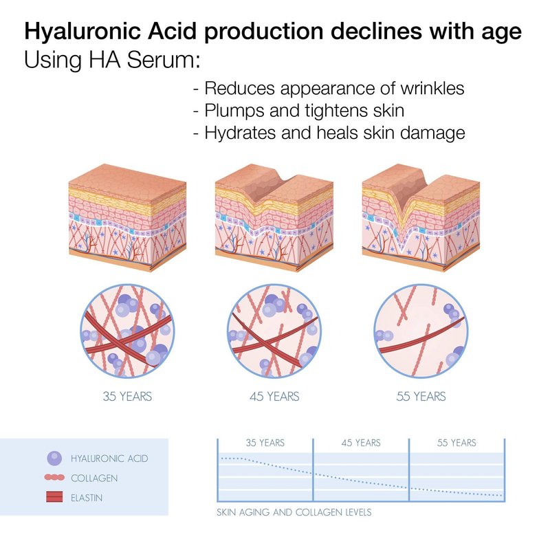 ALOA Skincare Hyaluronic Acid Serum for Face 2oz, Intense Hydration, Skin Plumping, Anti Aging, Anti Wrinkle, Daily Moisturizer for Fine Lines and Wrinkles