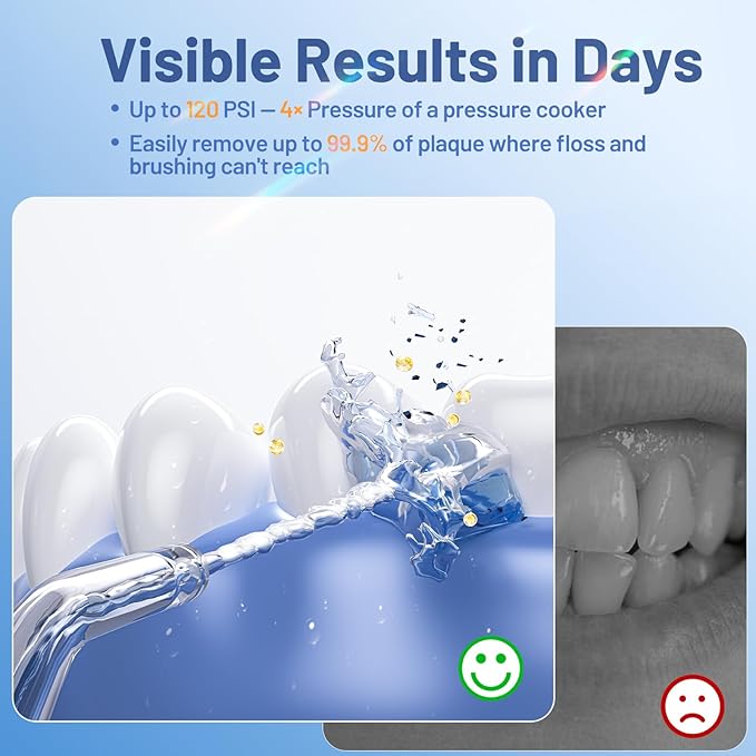 Water Flosser for Orthodontics Teeth Cleaning - Portable Electric Oral Irrigator Pick for Braces, Travel, Kids, with 3 Modes 8 Pressure Settings, 8 Tips, 150ML, IPX7, Gradient Blue