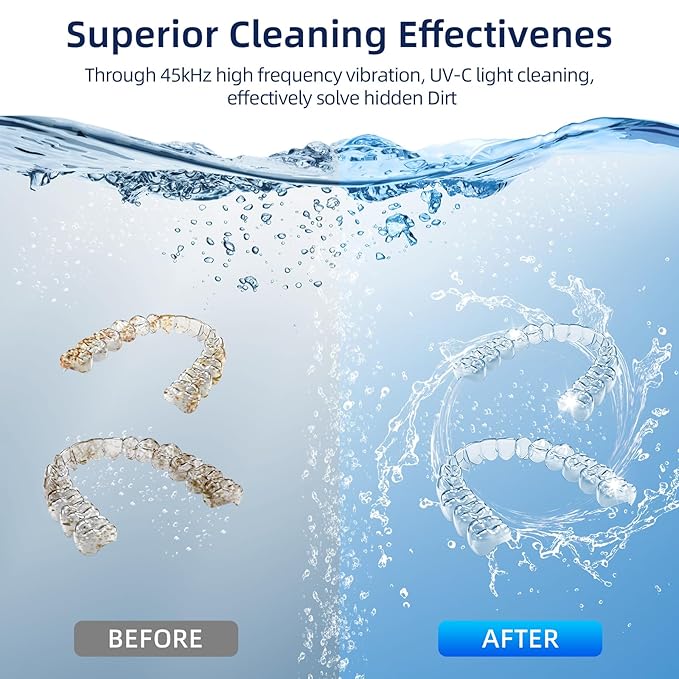 Ultrasonic Retainer Cleaner, Retainer Cleaner Machine for Dentures, Mouth Guards, Braces, Toothbrush Heads, Jewelry with 200ML Capacity, 45kHz Retainer Cleaning, 4 Modes for Appliances, Blue