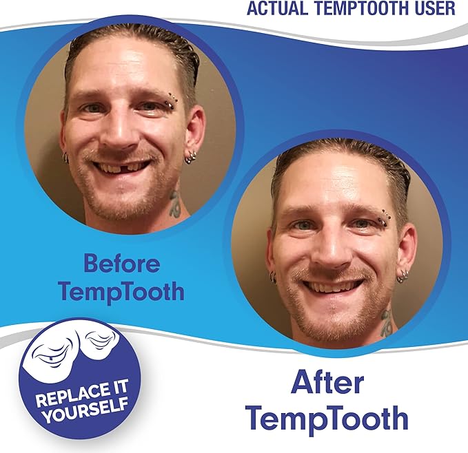 Temptooth #1 Seller Trusted Patented Temporary Tooth Replacement Product