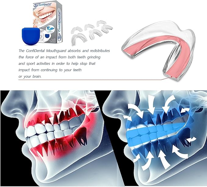 The ConfiDental Mouth Guard for Teeth Grinding & Clenching Pack of 6 Moldable Night Guards for Bruxism, Custom-Fit Protection for Comfortable Day & Night Use