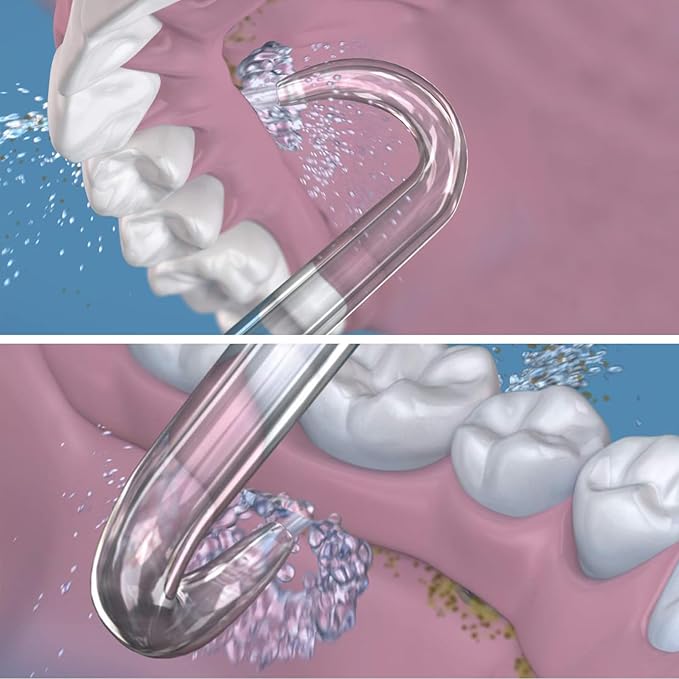 Professional Replacement Tips for Waterpik Water Flosser - 6 Implant Denture Tips