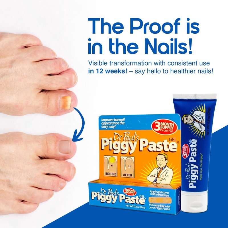 Dr. Paul's Piggy Paste Gel 2-Pack: Fast Acting Solution for Thick, Brittle, Yellow Nails, Restores Clear, Healthy Toenails & Fingernails Easy, Mess-Free Application Doctor Recommended Formula