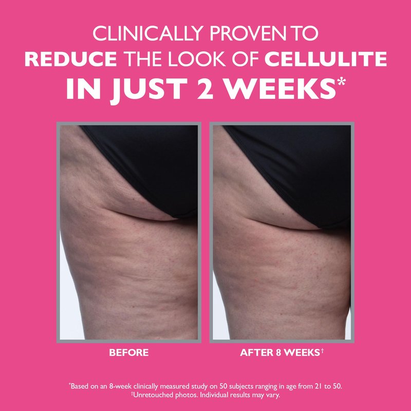 Peter Thomas Roth | FIRMx® Tight & Toned Cellulite Treatment, Body Cream, Clinically Proven to Reduce the Look of Cellulite In Just 2 Weeks