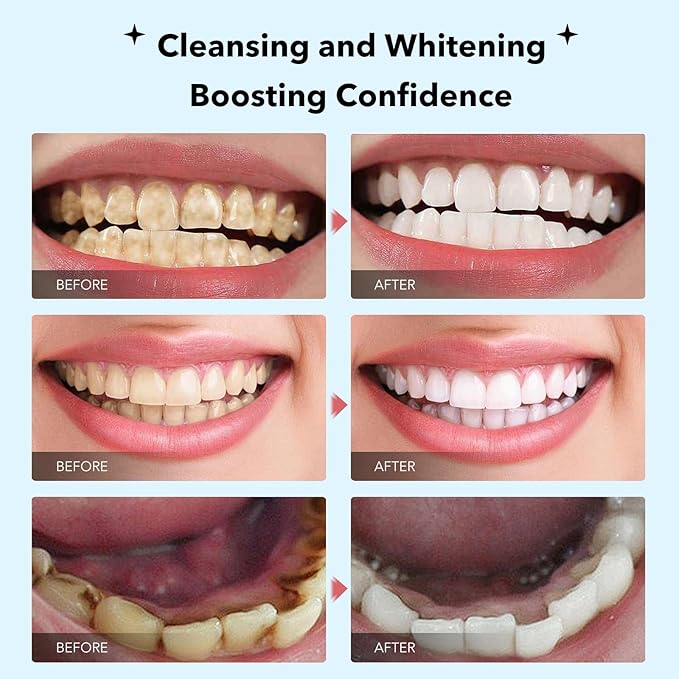 Fluoride Free Nano Hydroxyapatite Toothpastes for Teeth Whitening, Remineralizing, Deep Cleansing, Enamel-Safe, Anti-Plaque, Teeth Restoration, 4.23oz
