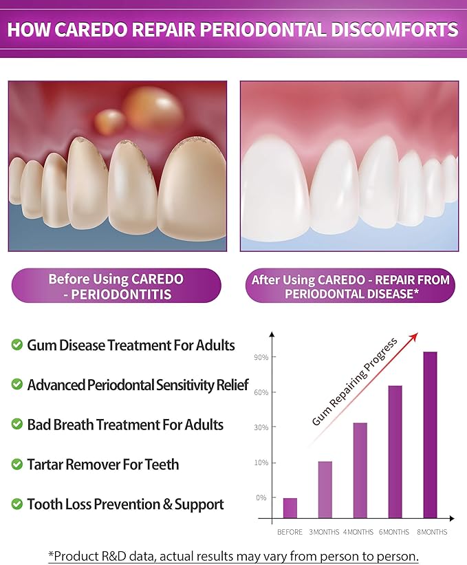 Gum Toothpaste for Periodontitis, Gum Repair for Receding Gums, Gum Disease & Gingivitis Treatment, Periodontal Disease Treatment for Gum Health, Gum Disease Repair Bad Breath Toothpaste 2 Pack