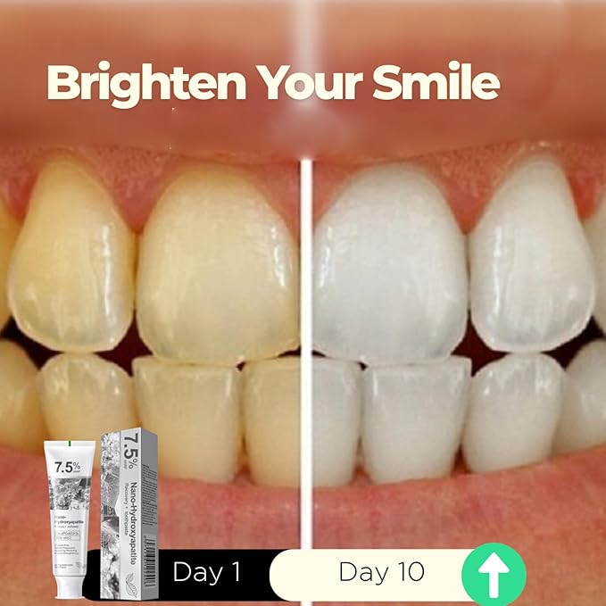 Hydroxyapatite Toothpaste, 7.5% Nano Hydroxyapatite Toothpast, Deep Cleaning for Advanced Enamel Protection, Fluoride-Free Gentle and Effective Formula with Fresh Mint (2 Sets)