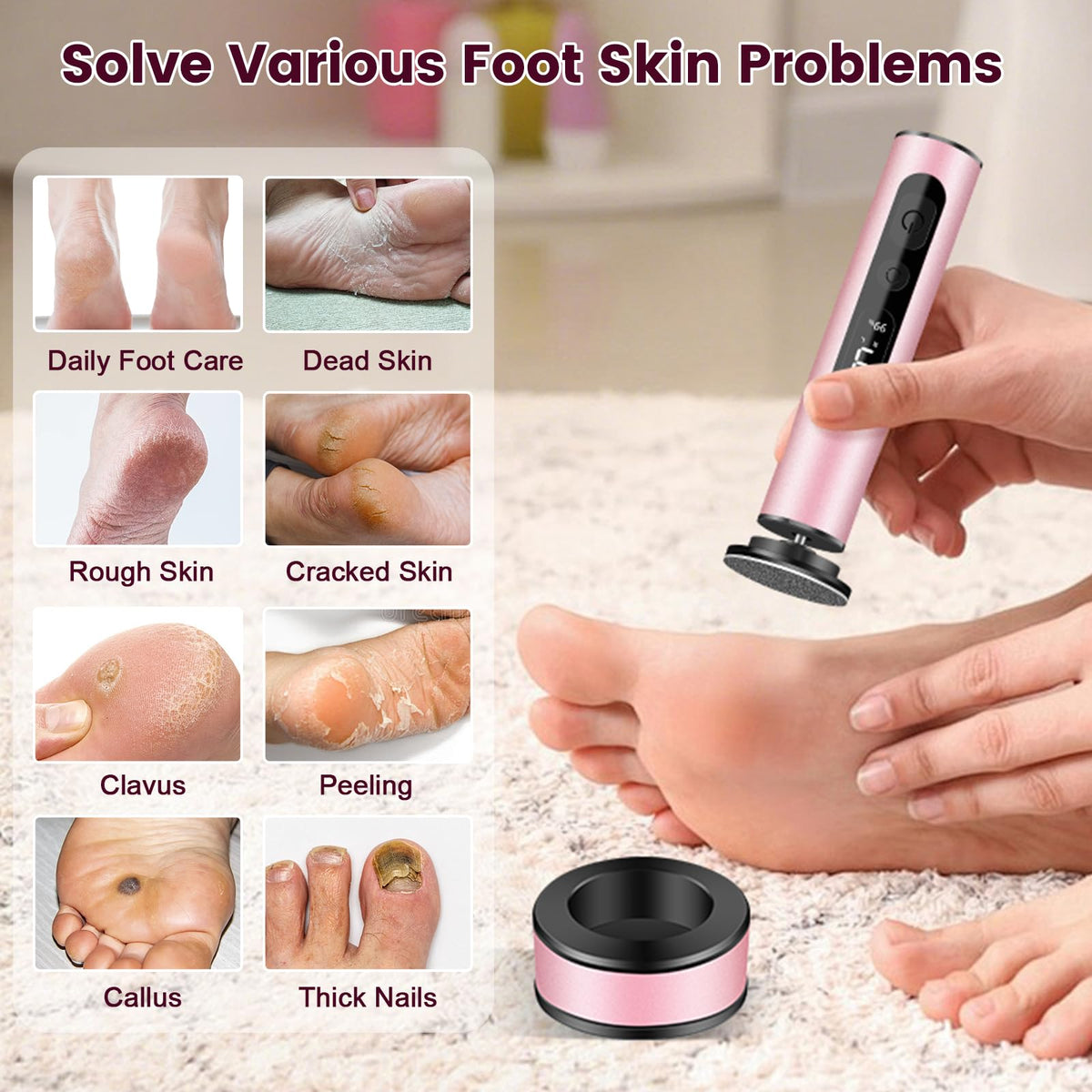 EFCRBS Electric Foot Callus Remover with LED Battery Level (Pink)