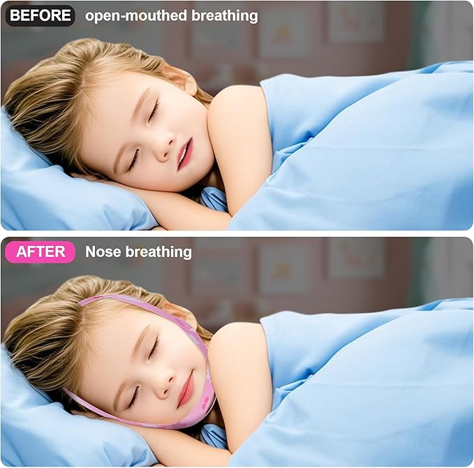 2025 Anti-Snoring Chin Strap for Sleeping Kids - Professional Anti-Snoring Solution, Small Chin Strap for Snoring,Breathable and Adjustable, Fits Kids 3'9"-5'3" Tall and Weighing 33-132 lbs