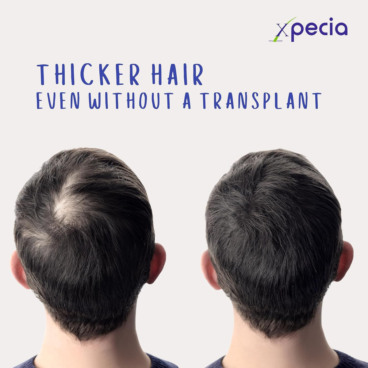 XPECIA FOR MEN ANTI HAIR LOSS DHT BLOCKER NEW HAIR GROWTH FORMULA 60 TABLETS