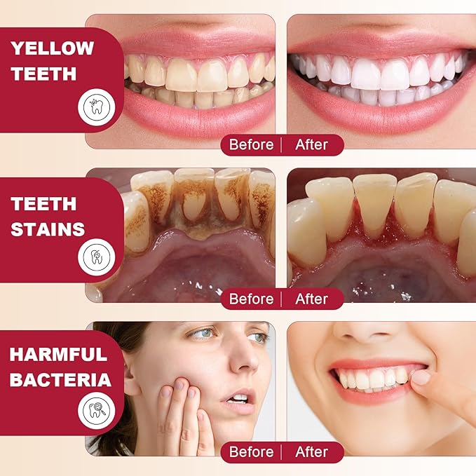 2 Pcs Sp-6 Probiotic Ultra Whitening Toothpaste, Sp 6 Toothpaste, Deep Cleaning Care, Stain Removing, Fresh Breath.