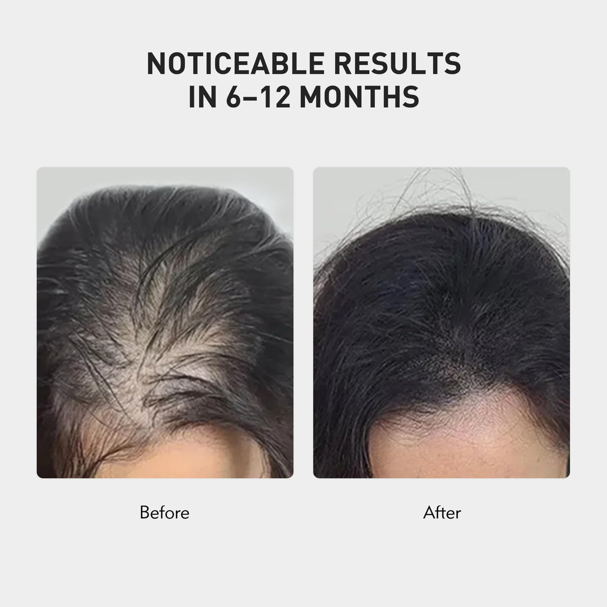 0.9% KX-826 KINTOR Hair Growth Spray,Strengthen Hair Nourish Hair follicles,Hair Care Products for Sparse Hair and Oily Hair Men&Women,60ml,Pro