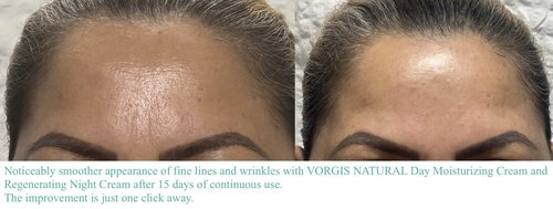 VORGIS NATURAL Eye Contour Cream Day & Night with Hyaluronic Acid.