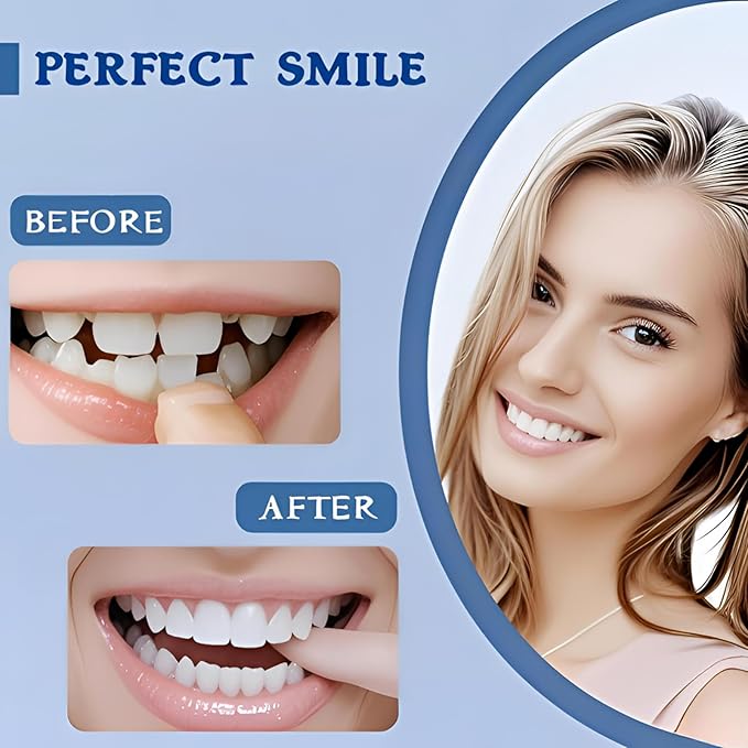 2 Pairs of Smile Supports, Quickly Restore Smile and Regain Confidence (White) Adjustable Comfort.