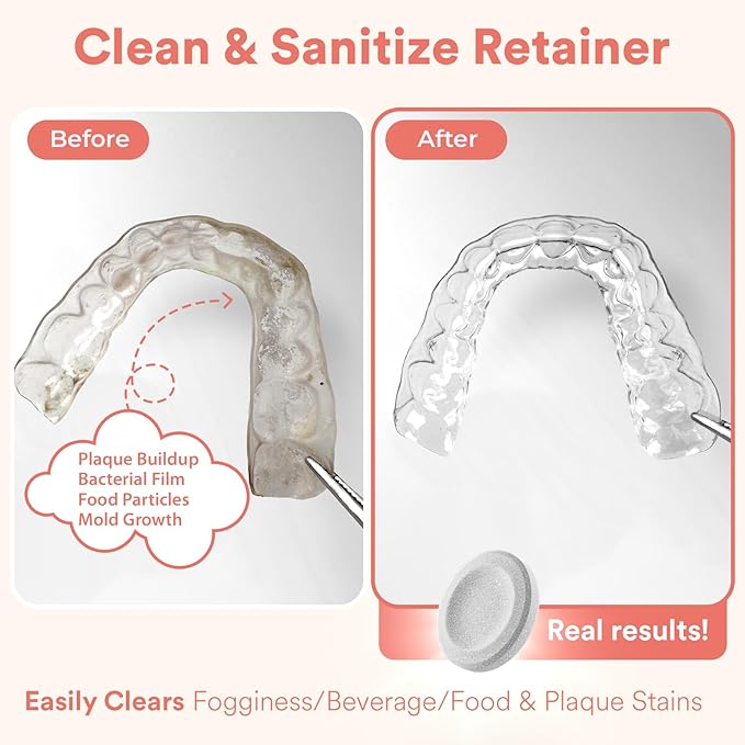 Weiss Naturals Retainer Cleaner Tablets, Invisalign Cleaner, Remove Stains, Odors & Plaque, FSA & HSA Eligible, Night Guard Cleaners PERSULFATE & DYE-FREE 4-Month Supply, Denture Cleaners 120 Tablets