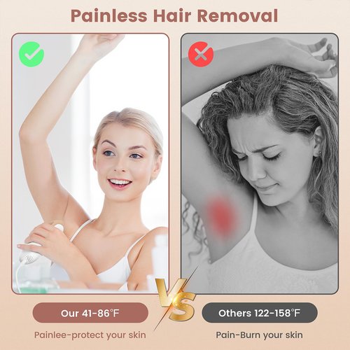 FELOOW IPL Hair Removal Device, Hair Removal for Women and Men at home for Armpits Legs Arms Bikini Line，model S3