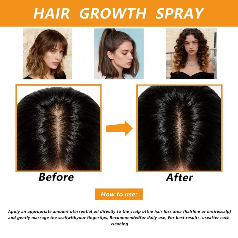 Hair Growth Spray with Rosemary Oil & Biotin- Lightweight, Non-Greasy, Nourishes Scalp & Boosts Hair Fullness, 60ml Bottle (1)