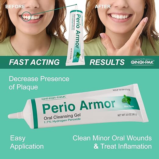 Perio Armor 1.7% HP Oral Cleansing Gel for Healthy Gums and A White Smile - Boost Whitening & Freshness with This Non-Invasive Treatment, 3 oz, Mint
