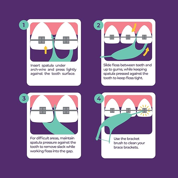 Platypus Orthodontic Flossers for Braces, 40 Count (Pack of 2), Ortho Picks for Adults & Kids, Fits Under Arch Wire, Non-Damaging, Encourage Flossing Habits