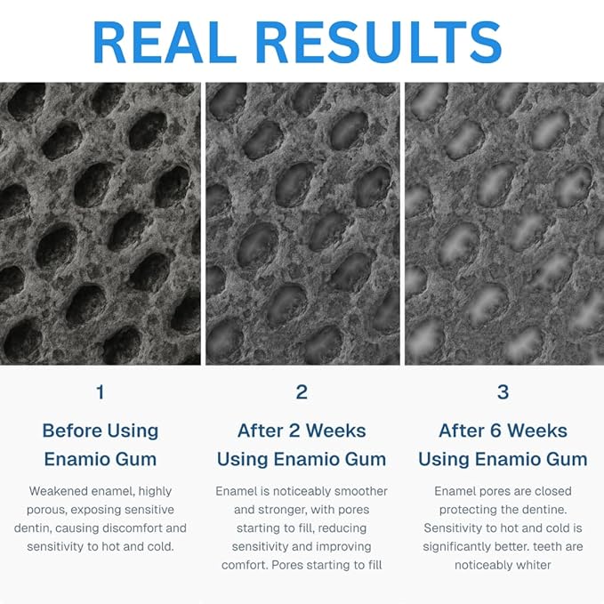 Enamio Berry Remineralizing Gum with Nano Hydroxyapatite for Enamel Support & Sensitive Teeth - Xylitol Gum, Plastic Free, Sugar Free, Natural Oral Care - No Aspartame- Made in USA - 4 Pack