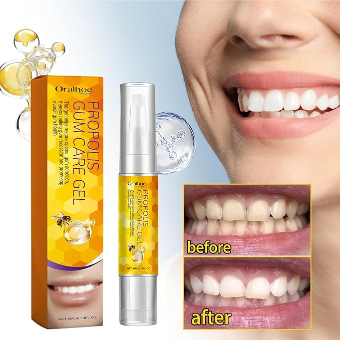 Propolis Gum Care Gel with Allantoin, Arginine and Calendula Extract, Soothing Oral Care Formula for Gingival Comfort and Mouth Health, Natural Ingredients, 4ml