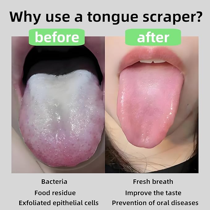 Tongue Scraper Bling Metal Tongue Cleaner for Adults & Kids Diamond Stainless Steel Tongue Scrubber for Oral Care & Hygiene(Blue)