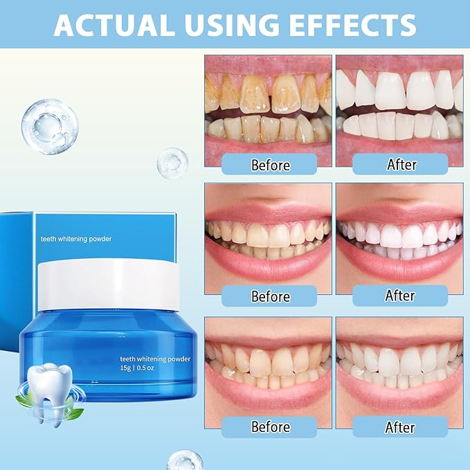 Teeth Whitening Powder, Natural Teeth Whitener, Teeth Whitening Powder Toothpaste, Instant Teeth Whitening and Stain Removal, Fresh Breath (2PCS)