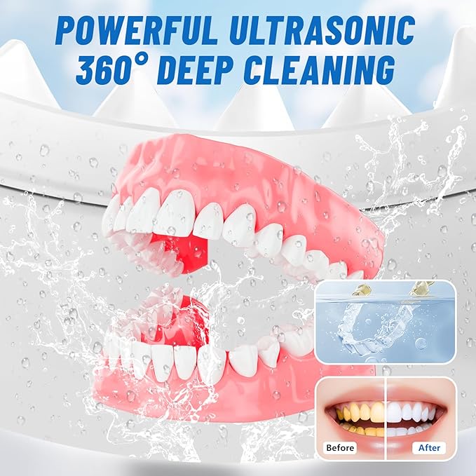 Ultrasonic Retainer Cleaner Machine for Dentures | 45kHz Dental Cleaning Pod for Aligner, Nightguard, Braces, Jewelry, Watch, 3 Timer Modes - with Cooling Fan & Removable Base Moonlight White