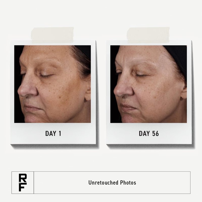 Rodan + Fields Reverse Deep Exfoliating Facial Cleanser with Glycolic Acid & AHAs | Daily AHA Exfoliating Face Wash for Pore Refining & Smoother Skin Texture | 125 mL