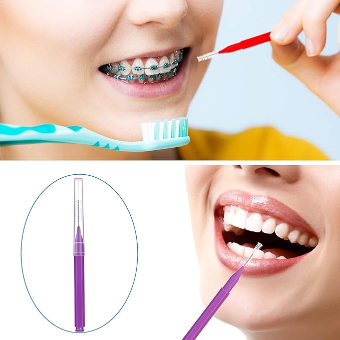 Patelai 100 Pieces Braces Brush for Cleaner Interdental Brush Toothpick Dental Tooth Flossing Head Oral Dental Hygiene Flosser Toothpick Cleaners Tooth Cleaning Tool(Mixed Colors,Mixed Sizes)