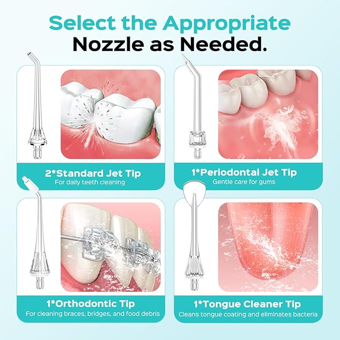 COSLUS Original Water Flosser Replacement Tips: Replacement Heads Compatible with COSLUS, Aquasonic, Nicwell, Oralfree, WELLFINE, Hangsun, Tovendor Water Dental Pick, Accessory, 4 Periodontal Jet Tips