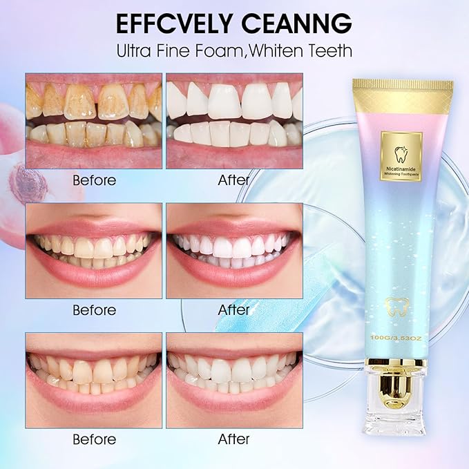 Niacinamide Whitening Toothpaste, Niacinamid Toothpast, Complete Care Toothpaste, Repair and Protect Teeth, Remove Tooth Stains, Fresh Breath(2PCS)