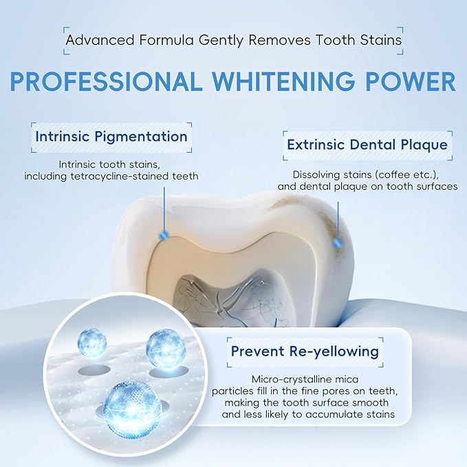 Teeth Whitening Gel –30ml, Dentist Developed WhitePlus Edition (Food-Grade Silicone Mouth Tray Included)