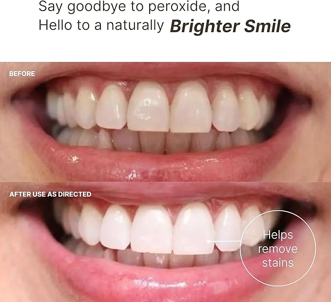 Nu Skin AP 24 Whitening Fluoride Toothpaste | AP 24 Blend | Vanilla Mint Flavor | Brightens Teeth | Removes Surface Stains | Prevents Dental Cavities & Plaque | Enamel-Safe | 4 oz | 1 Pack
