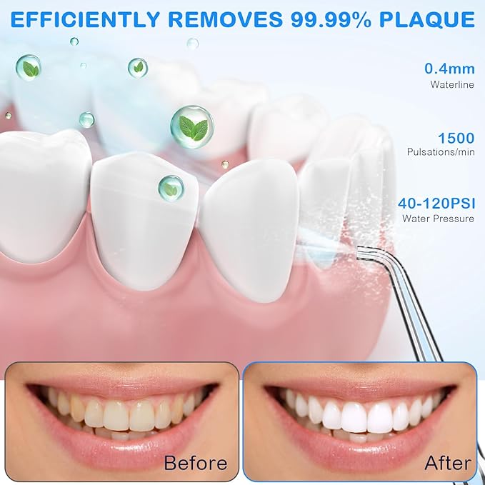 Water Dental Flosser for Teeth Cleaning and Flossing with Travel Size Case – Rechargeable Oral Irrigator, KOOVON Portable Water Flosser for Adults, IPX7 Waterproof, 5 Jet Tips & 4 Modes, Blue