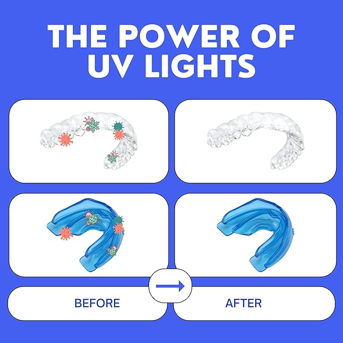 UV Retainer Case for Invisalign, Aligners, Dental Braces, Mouth Guard, Dentures and Night Guard - Small and Portable UV Retainer Cleaner Case with UVC Lights (Pink & White)