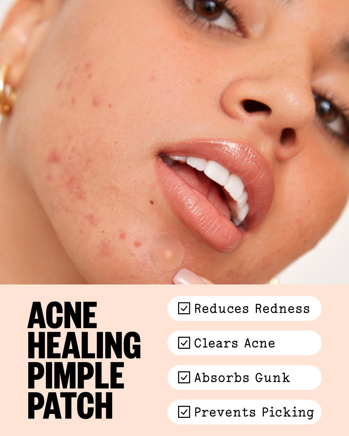 PEACE OUT Acne Healing Dots Hydrocolloid Pimple Patches (60 count)