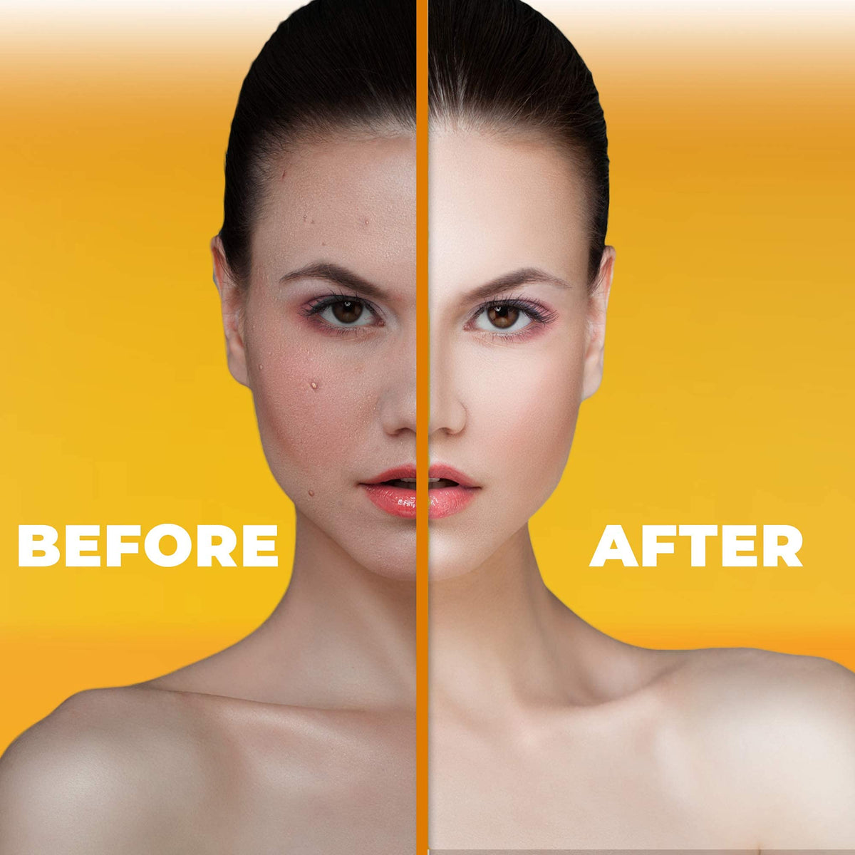 New York Bright & Lovely, Hyaluronic Acid Serum for Face | 1 Fl oz / 30 ml | Anti Aging, Anti Wrinkle, Spotless Treatment, Advanced Formula, with Vitamin C, For Women and Men