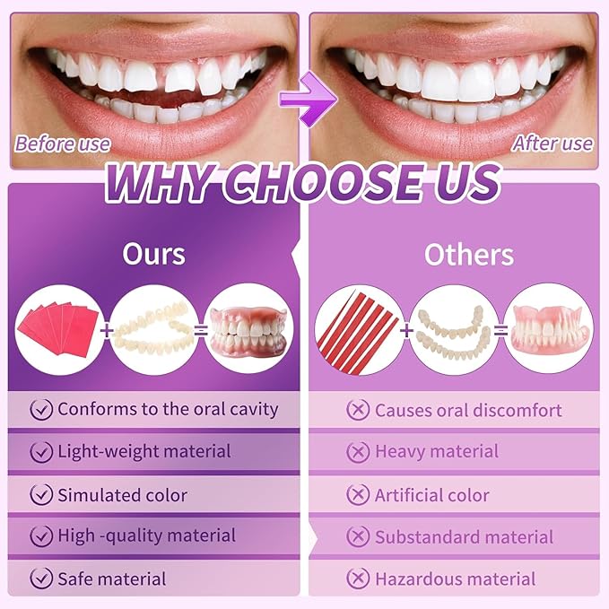 At-Home DIY Denture Kit – Full Set Upper & Lower False Teeth, Reusable Resin, Customizable Fit, A03