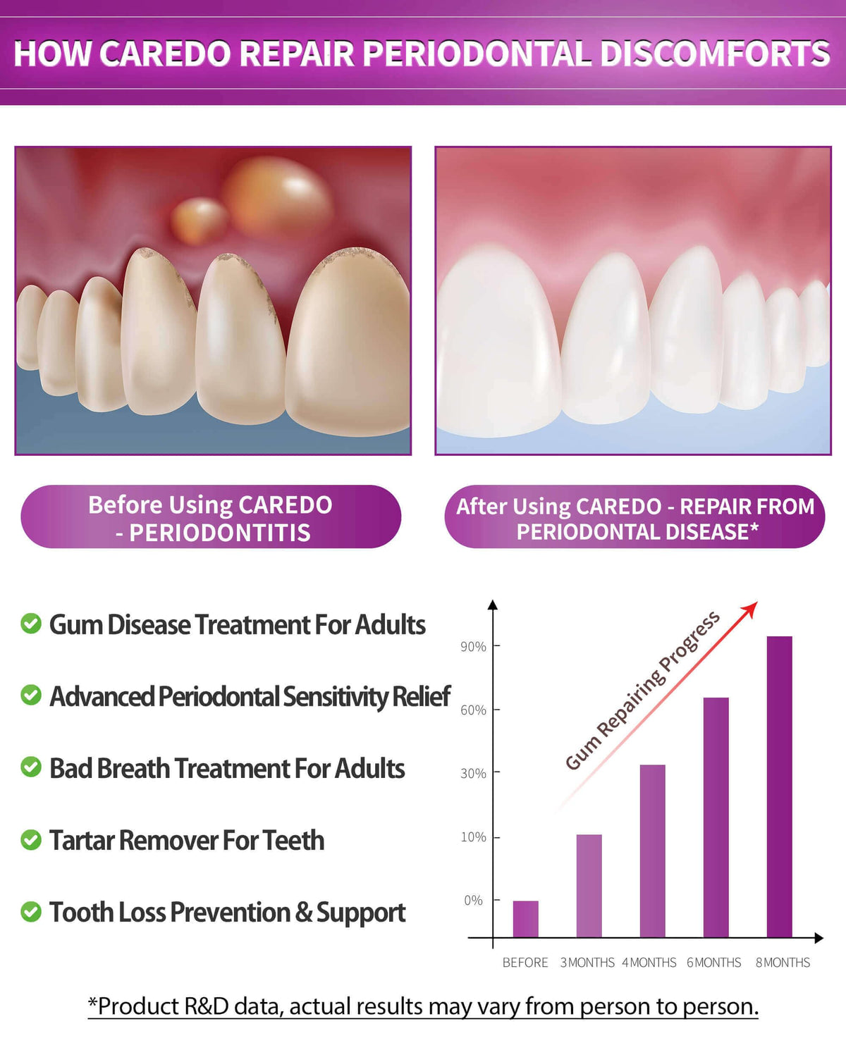 CAREDO Gum Toothpaste for Periodontitis, Gum Repair for Receding Gums, Gum Disease & Gingivitis Treatment, Periodontal Disease Treatment for Gum Health, Gum Disease Repair Bad Breath Toothpaste 3.52OZ