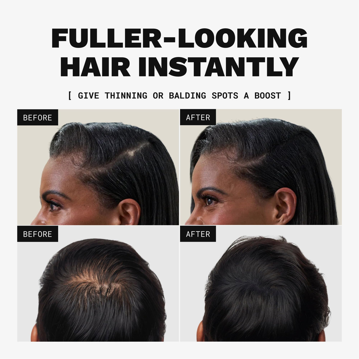 Toppik Hair Building Fibers, Black, 27.5g Fill In Fine or Thinning Hair, Instantly Thicker, Fuller Looking, 9 Shades for Men & Women, Keratin Protein Formula