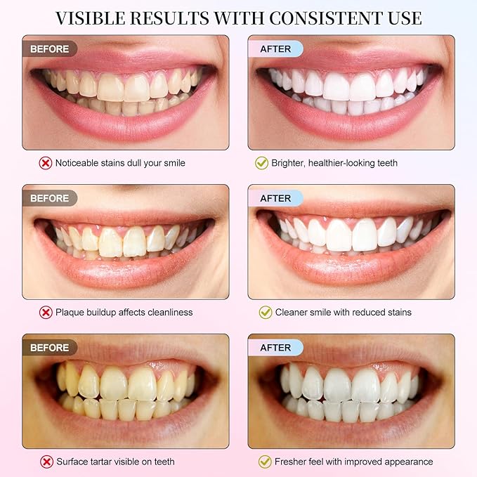 Niacinamide Whitening Toothpaste, Radiant Whitening Toothpaste, Stain Removal Natural, Complete Care, Enamel Repair, Freshes Breath, for Healthier and Whiter Teeth 2 PCS