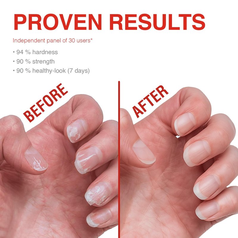 Probelle Nail Strengthener and growth, Natural Nail Strengthening Clear Nail Polish Repair Treatment, Nail Growth & Conditioning, Stops Splits, Chips, Cracks & Strengthens Damaged and Thin Nails
