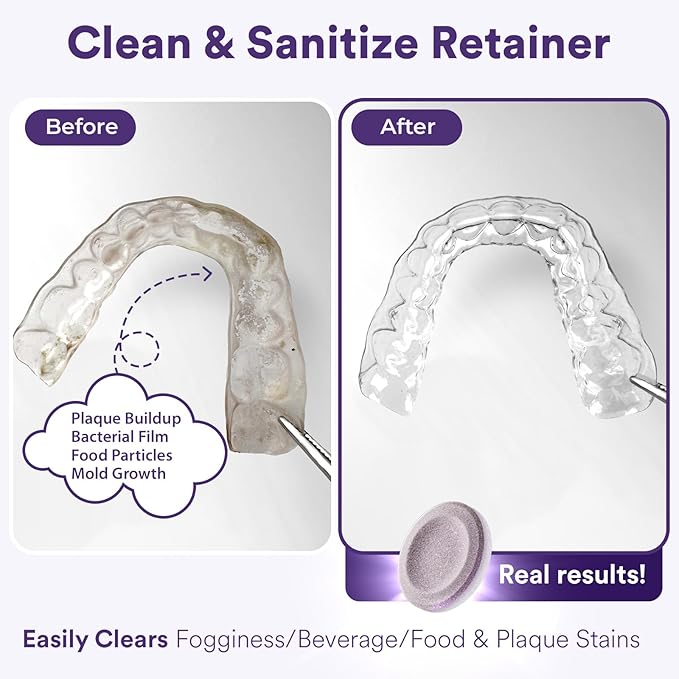 Weiss Naturals Retainer Cleaner Tablets, Invisalign Cleaner, Remove Stains, Odors & Plaque, PERSULFATE FREE Night Guard & Denture Cleaner 4-Month Supply, 120 Grape Scented Tablets