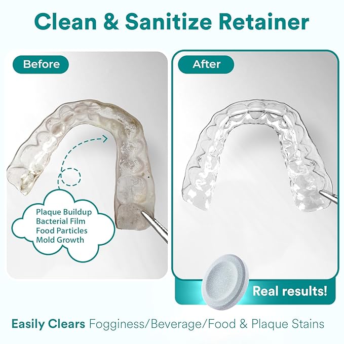 Weiss Naturals Retainer Cleaner Tablets, Invisalign Cleaner, Remove Stains, Odors & Plaque, PERSULFATE FREE Night Guard & Denture Cleaner 4-Month Supply, 120 Mint Scented Tablets