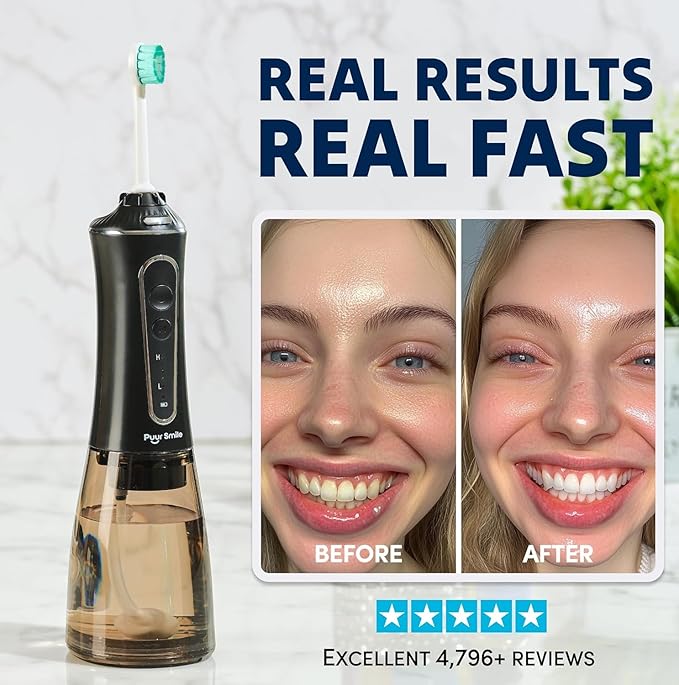 Professional Water Flosser - Advanced Dental Care for a Healthier Mouth, Gum, and Teeth - IPX7 Waterproof Oral Irrigator | 7 Replacement Tips, Travel-Friendly, Rechargeable - Oral Hygiene